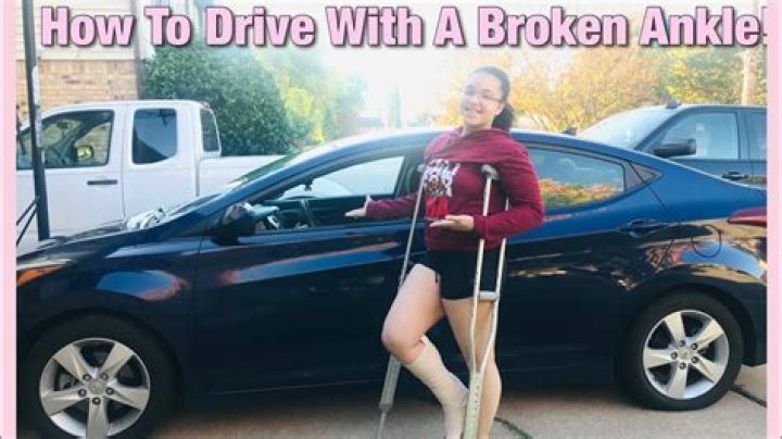 Can you drive with a broken ankle? ·
