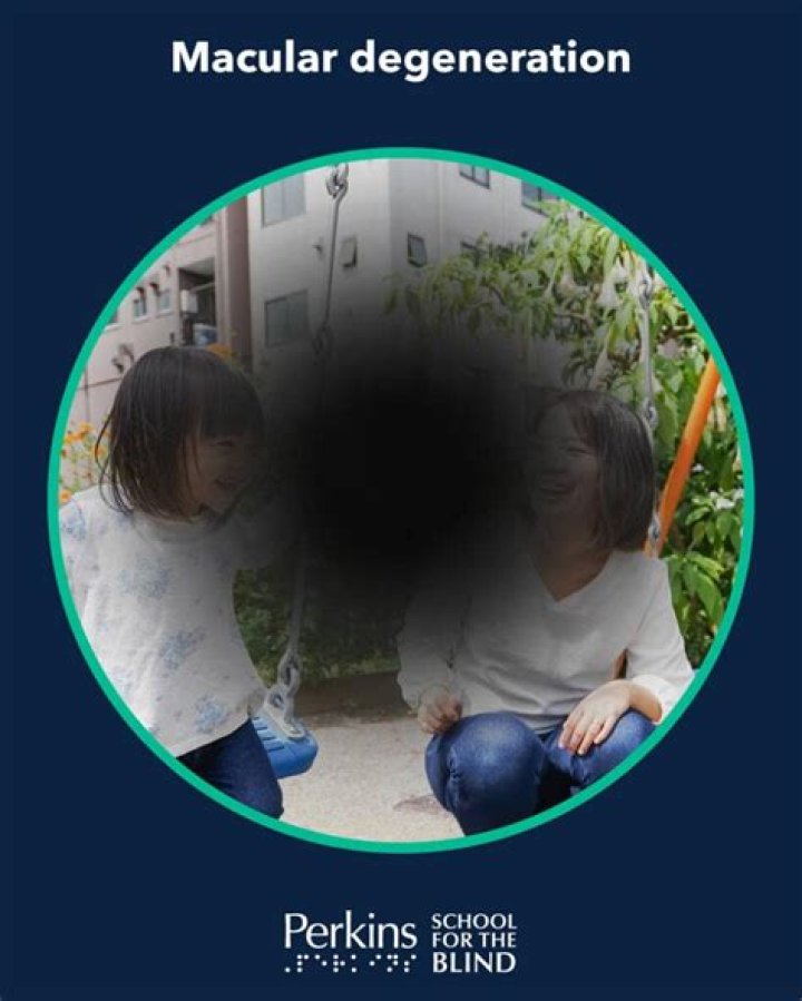 Do squid go blind? - Blogsia