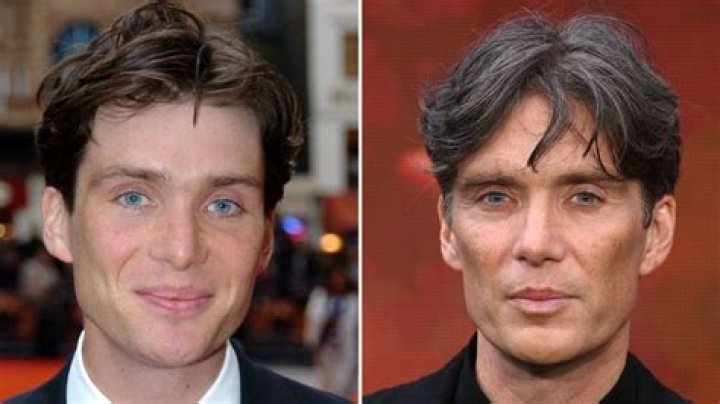 Does Cillian Murphy's Youthful Appearance Result From Botox?