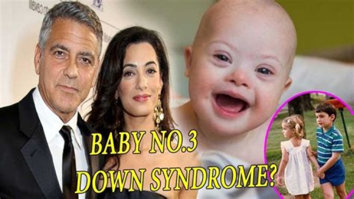 Does George Clooney's Son Spark Speculation About Down Syndrome?
