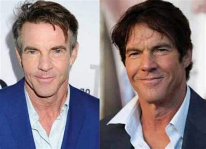 Has Dennis Quaid Embraced Plastic Surgery?