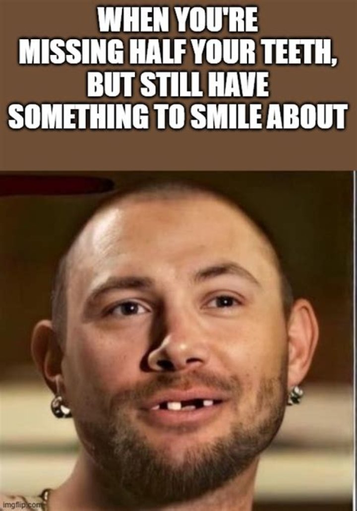 Hilarious Missing Teeth Memes: Brace Yourself For A Grin!