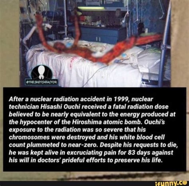 Hisashi Ouchi: The Man Who Survived A Lethal Dose Of Radiation