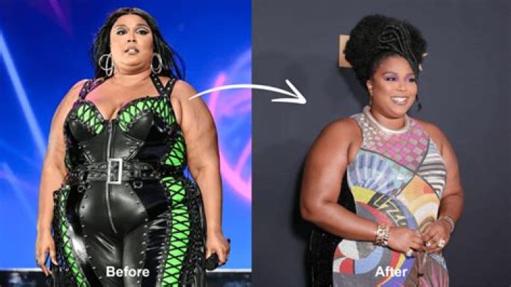 The Ultimate Guide To Lizzo's Weight Loss Surgery: Costs And Details