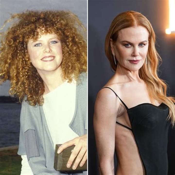 Is Nicole Kidman's Plastic Surgery A Masterpiece Or A Mistake?