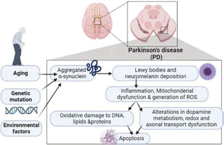 Is Parkinson's Disease A Factor?
