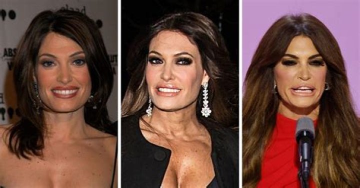 Kimberly Guilfoyle's Plastic Surgery Journey: A Transformation Uncovered