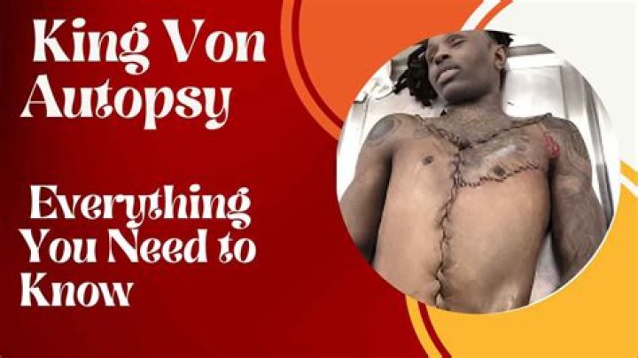 King Von's Autopsy Report Revealed