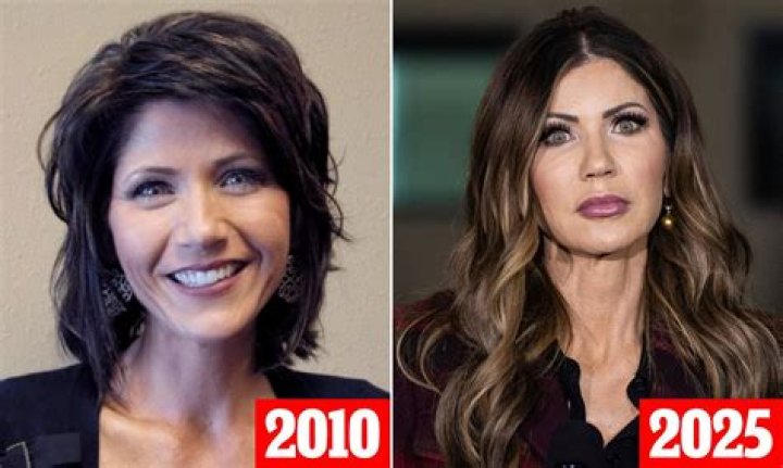 Kristi Noem's Stunning Transformation: Before And After