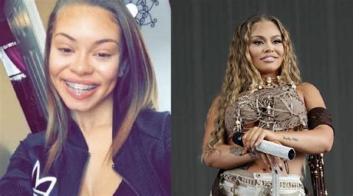 Unveiling The Secrets: Latto Before Surgery