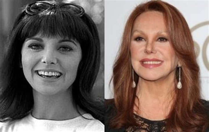 Marlo Thomas's Nose Job: Uncovering The Untold Story
