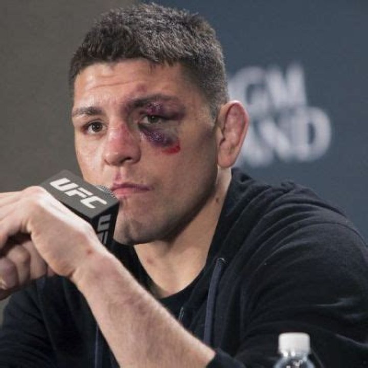 Nick Diaz- Wiki, Age, Height, Wife, Net Worth, Ethnicity ·