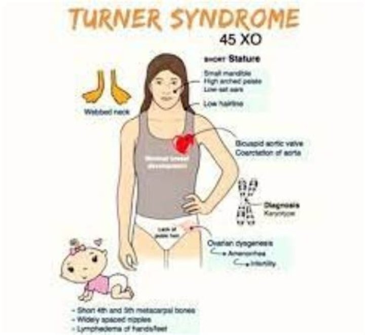 Remarkable Women Embracing Turner Syndrome