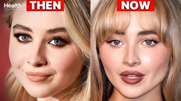 See How Sabrina Carpenter Has Transformed Post-Surgery!