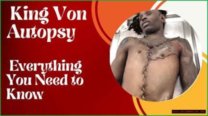 The Disturbing Truth: King Von Autopsy Photos Uncovered