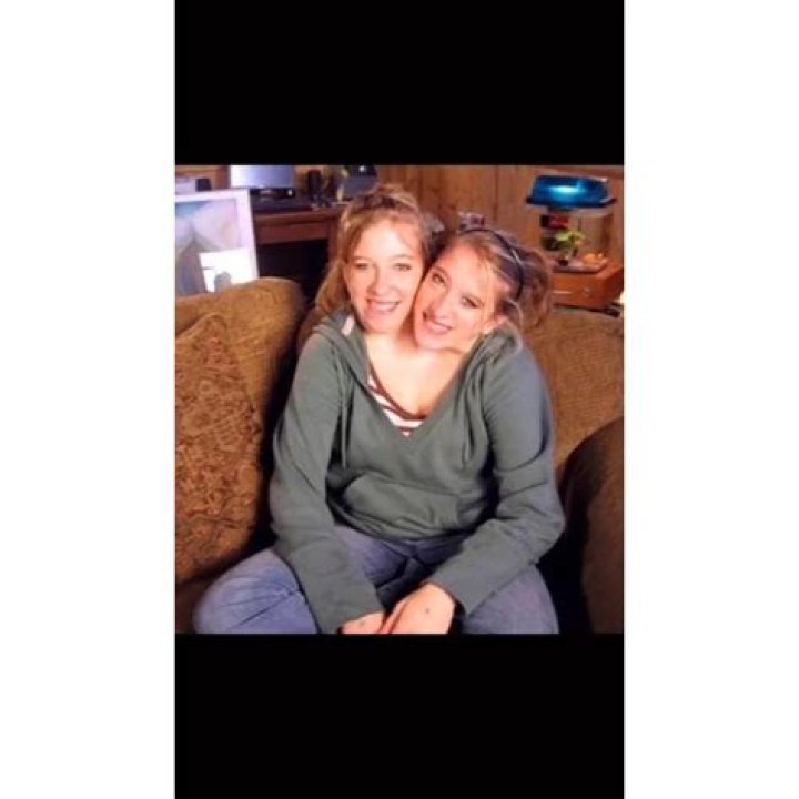 The Tragic Tale Of Conjoined Twins Abby And Brittany Hensel