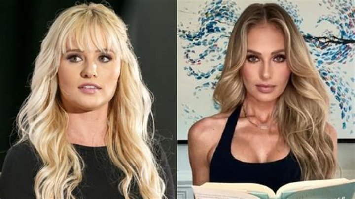 Tomi Lahren's Plastic Surgery Journey Revealed