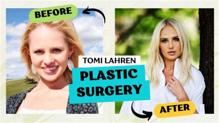 Tomi Lauren's Plastic Surgery Journey