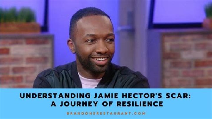 Uncover The Hidden Truths Behind Jamie Hector's Iconic Scar