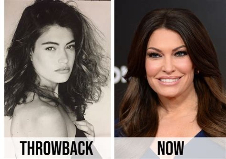 Unveiling The Truth: Kimberley Guilfoyle's Plastic Surgery Journey